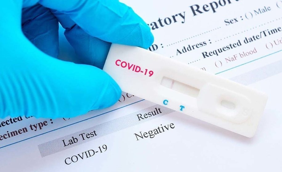 ¿Qué sabemos de los test de seroprevalencia para el COVID-19?