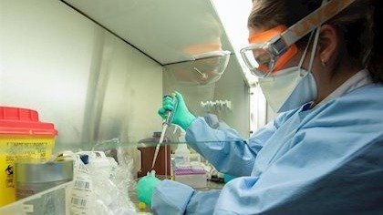 Os laboratorios teñen unha inxente carga de traballo diagnóstico.