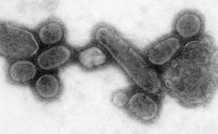 Reconstrucci&oacute;n do virus da gripe de 1918.