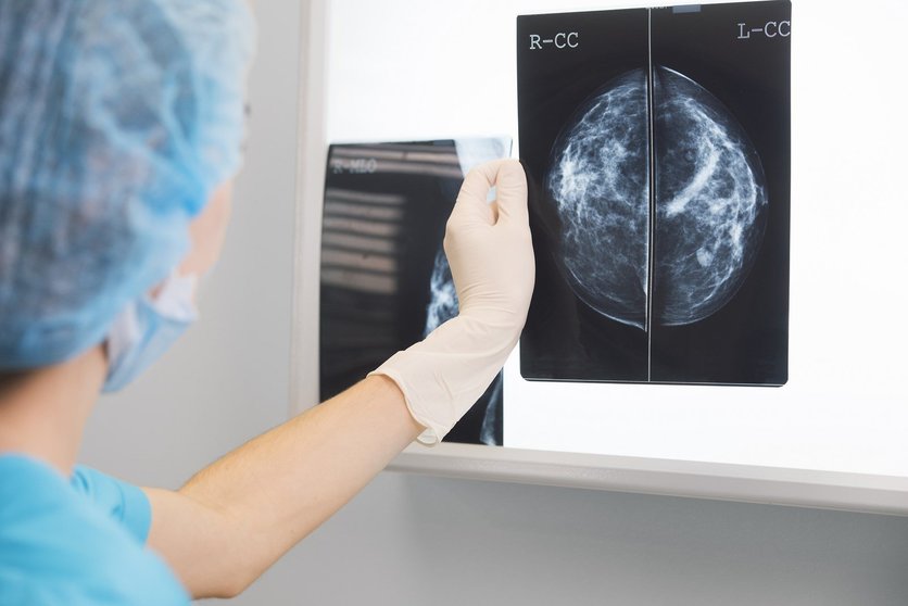 Observación de una mamografía.