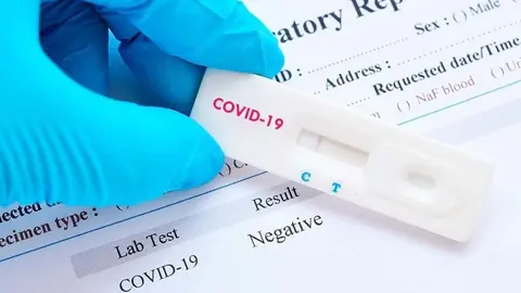 &iquest;Qu&eacute; sabemos de los test de seroprevalencia para el COVID-19?