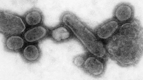 Reconstrucci&oacute;n do virus da gripe de 1918.
