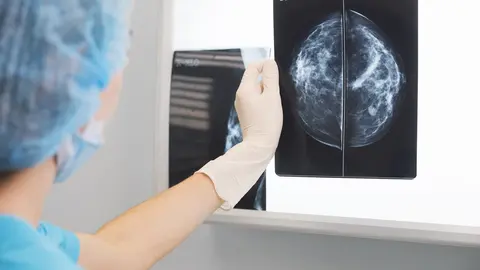Observaci&oacute;n de una mamograf&iacute;a.